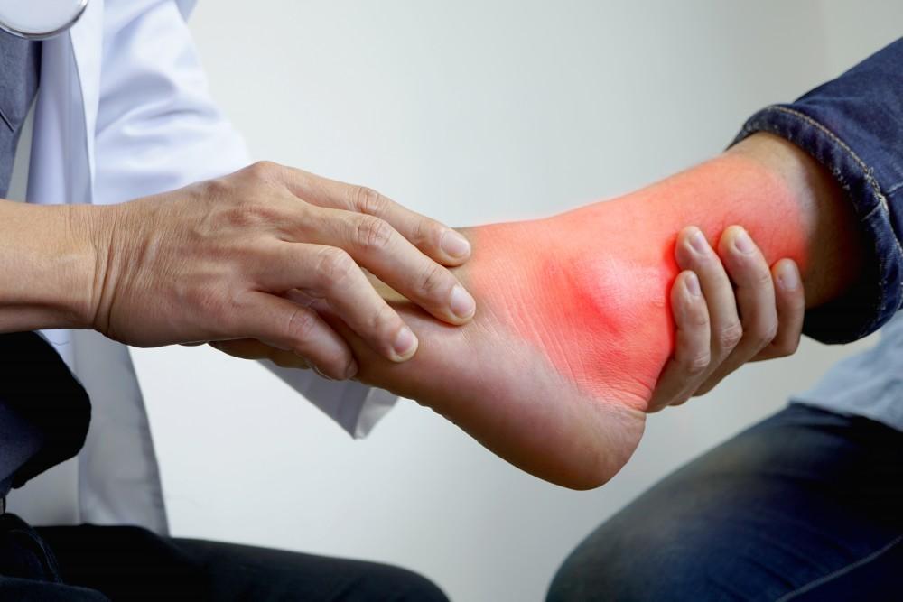 Understanding Gout: Causes And Symptoms