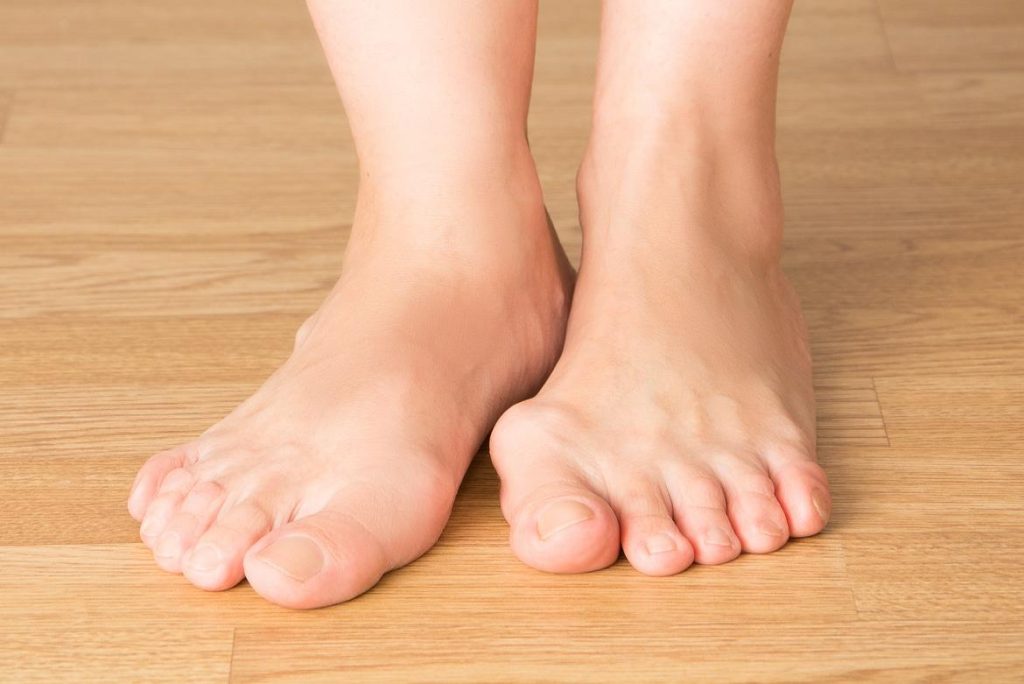 Understanding Gout And Its Causes