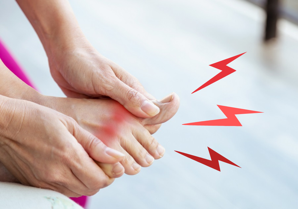 Most Common Symptoms Of Gout Flares