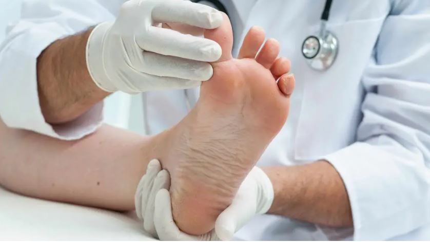 Understanding Gout and Uric Acid Level