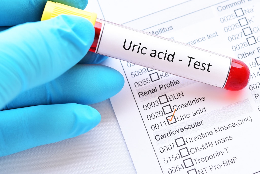 Causes Of High Uric Acid In The Blood