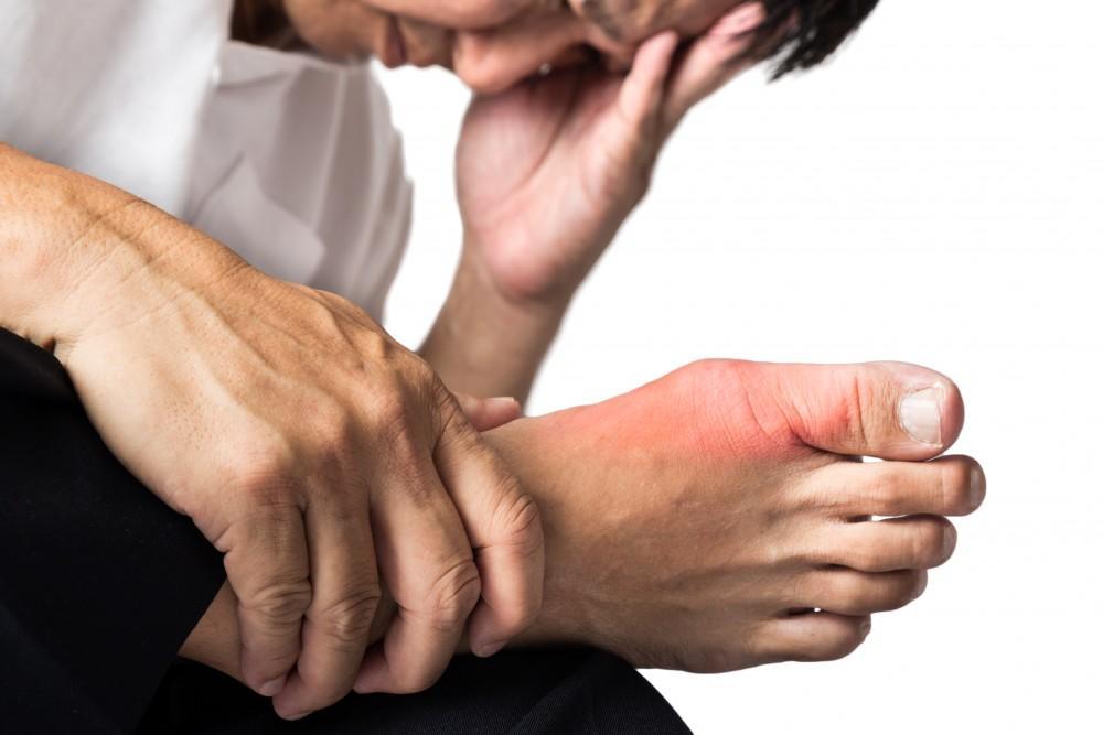 What is Gout and Uric Acid Level?